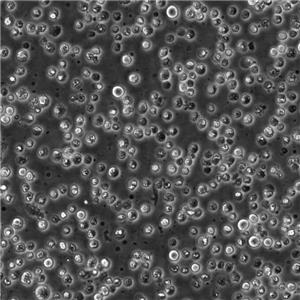 P3/NS-1 Cells#小鼠骨髓瘤細胞系源頭種子庫|培養(yǎng)基|送STR圖譜,P3/NS-1 Cells#
