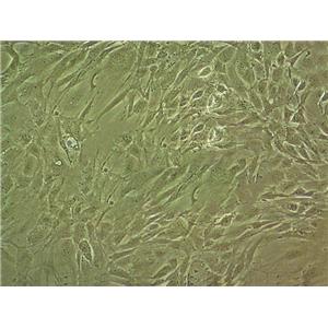 NCIH1563 Cells#人胚肺細胞系源頭種子庫|培養(yǎng)基|STR圖譜