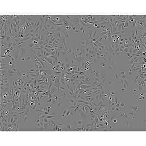 NCIH1395 Cells#人非小细胞肺癌细胞系源头种子库|培养基|STR图谱