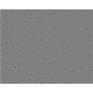 mda-415 Cells#人乳腺腺癌細胞系源頭種子庫|培養(yǎng)基|STR圖譜
