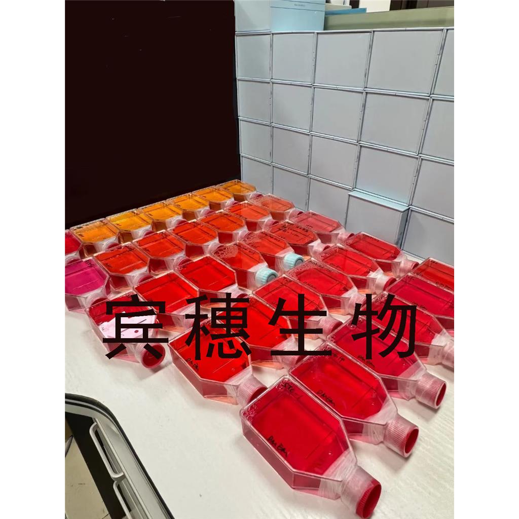 Hepatoma-22 Cells#小鼠肝癌細(xì)胞系保種中心(通過(guò)STR鑒定),Hepatoma-22 Cells#