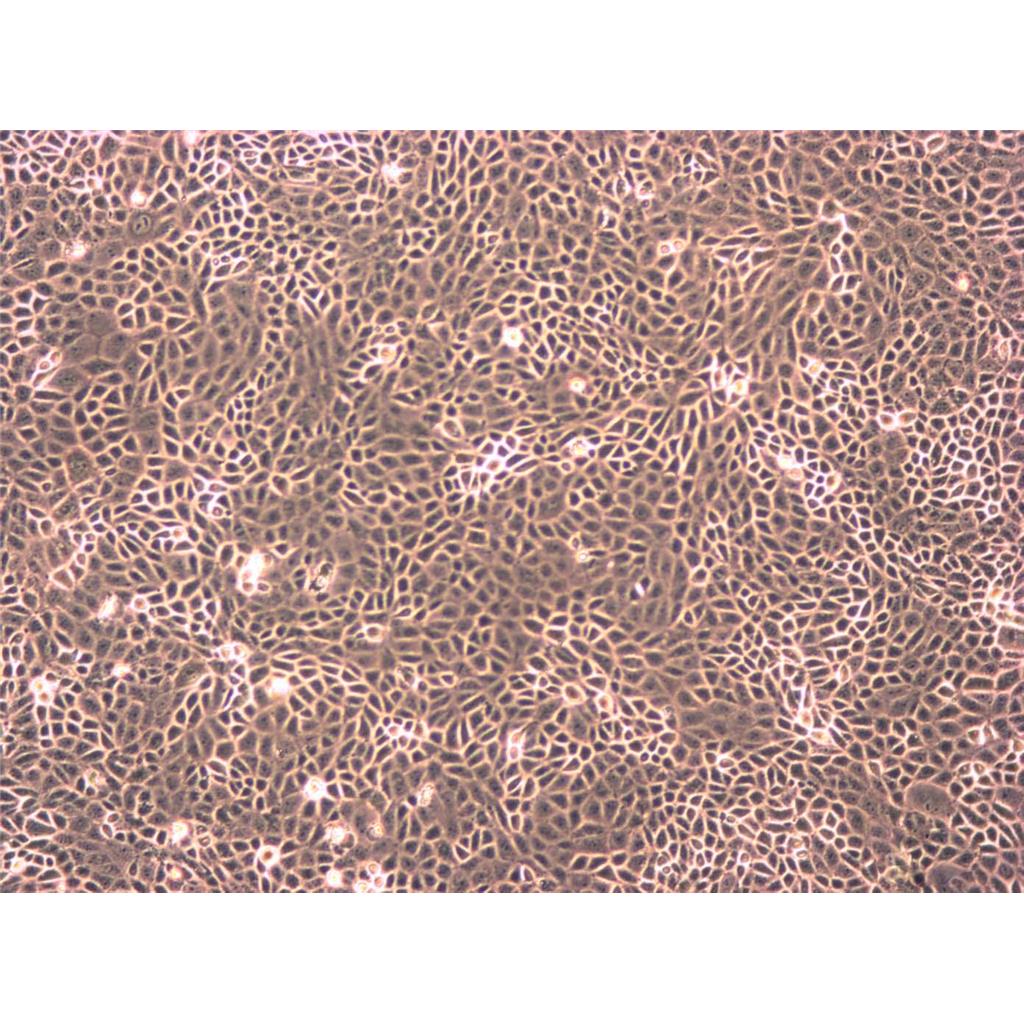 HCT.116 Cells#人結(jié)腸癌細(xì)胞系源頭種子庫(kù)|培養(yǎng)基|STR圖譜,HCT.116 Cells#