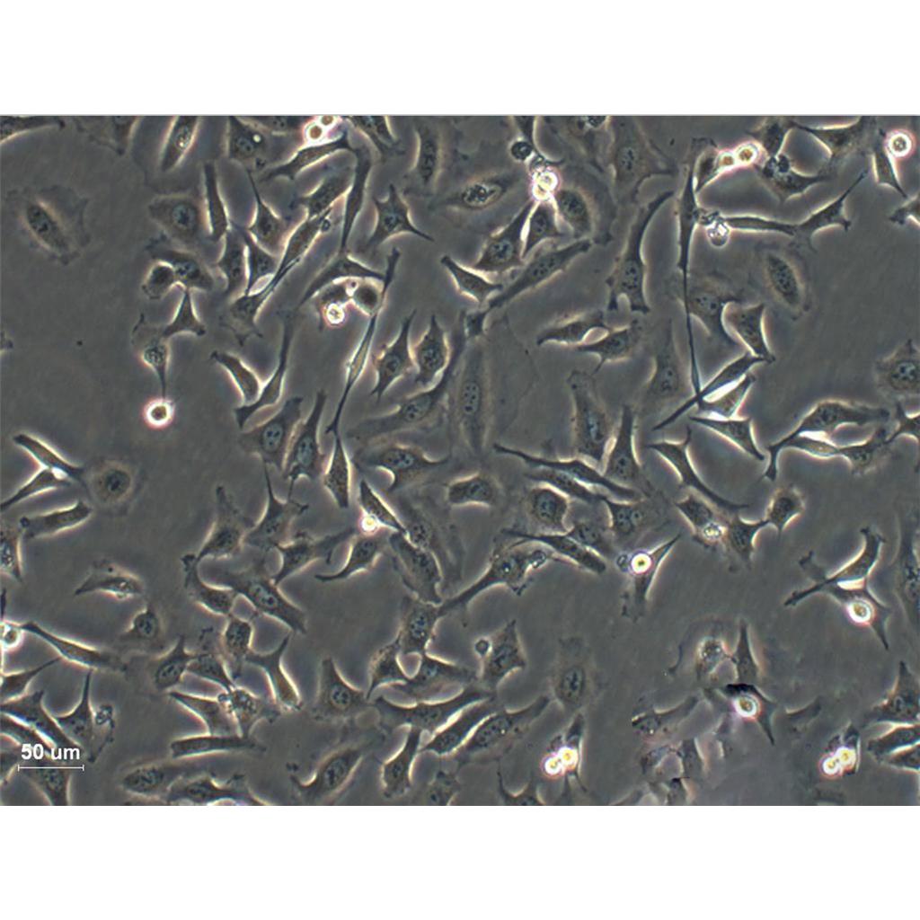 U-2OS Cells#人骨肉瘤細(xì)胞系源頭種子庫|培養(yǎng)基|STR圖譜,U-2OS Cells#