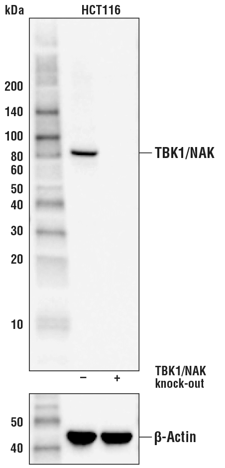 TBK1/NAK (D1B4) 兔單抗,TBK1/NAK (D1B4) Rabbit mAb