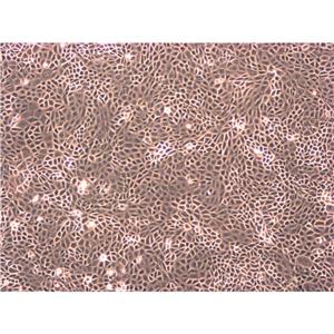 HCT.116 Cells#人結(jié)腸癌細(xì)胞系源頭種子庫(kù)|培養(yǎng)基|STR圖譜,HCT.116 Cells#