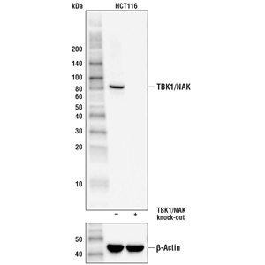 TBK1/NAK (D1B4) 兔單抗,TBK1/NAK (D1B4) Rabbit mAb