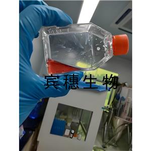 Jurkat, Clone E6-1人T淋巴细胞白血病细胞复苏中心|完全培养基|鉴定图谱