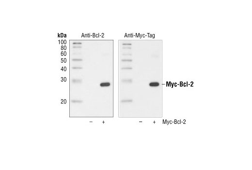 Myc标签（71D10）兔单克隆抗体,Myc-Tag (71D10) Rabbit mAb