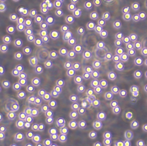 MT4 Cells人急性淋巴母細胞白血病懸浮細胞系(贈送STR基因圖譜),MT4 Cells