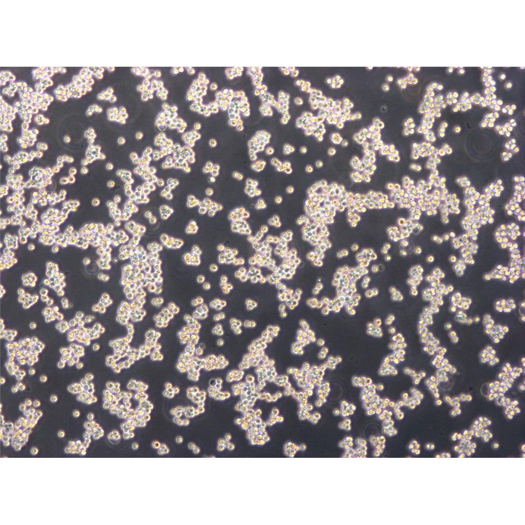 OCI-AML-3 Cells人急性髓細(xì)胞性白血病懸浮細(xì)胞系(贈(zèng)送STR基因圖譜),OCI-AML-3 Cells