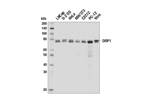 DRP1 (D6C7) 兔单克隆抗体,DRP1 (D6C7) Rabbit mAb