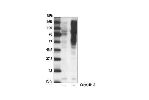 磷酸化絲氨酸/蘇氨酸苯丙氨酸抗體,Phospho-(Ser/Thr) Phe Antibody