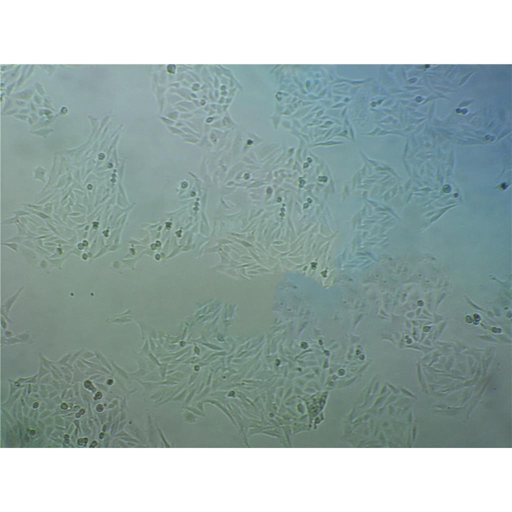 J774A.1 Cells小鼠單核巨噬細(xì)胞系(提供STR圖譜),J774A.1 Cells