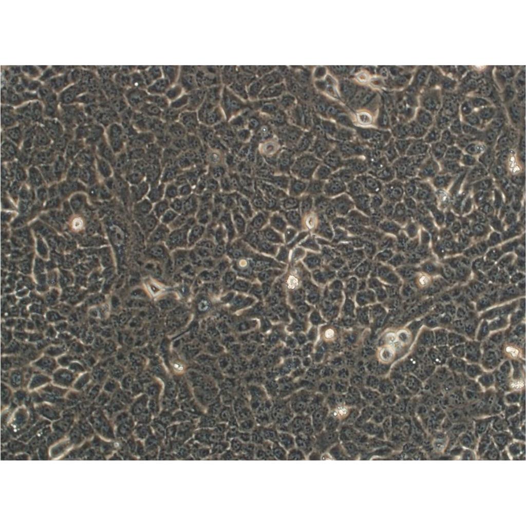 HCC1143 Cells人乳腺癌細胞系(提供STR圖譜),HCC1143 Cells