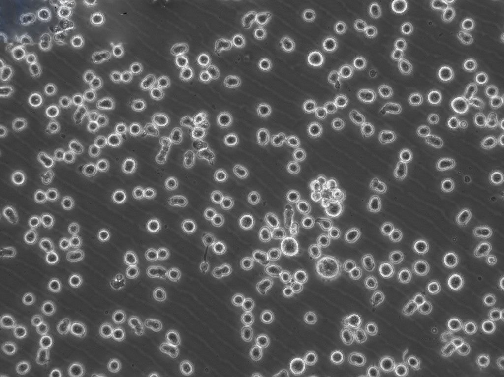 SU-DHL-4 Cells人B淋巴瘤懸浮細(xì)胞系(贈(zèng)送STR基因圖譜),SU-DHL-4 Cells