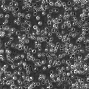 T2 (174 x CEM.T2) Cells人淋巴母懸浮細(xì)胞系(贈(zèng)送STR基因圖譜),T2 (174 x CEM.T2) Cells