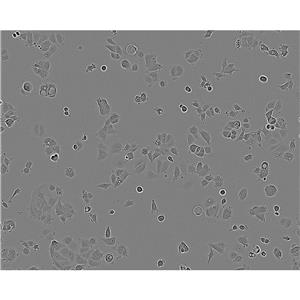 UM-SCC-1 Cells人口底鱗癌細(xì)胞系(提供STR圖譜),UM-SCC-1 Cells