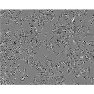 MT-4 Cells人T细胞白血病悬浮细胞系(赠送STR基因图谱)