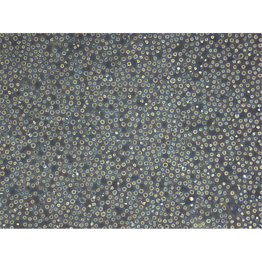 GM03190 Cells#人Burkkit淋巴瘤細(xì)胞系保種中心(通過(guò)STR鑒定),GM03190 Cells#