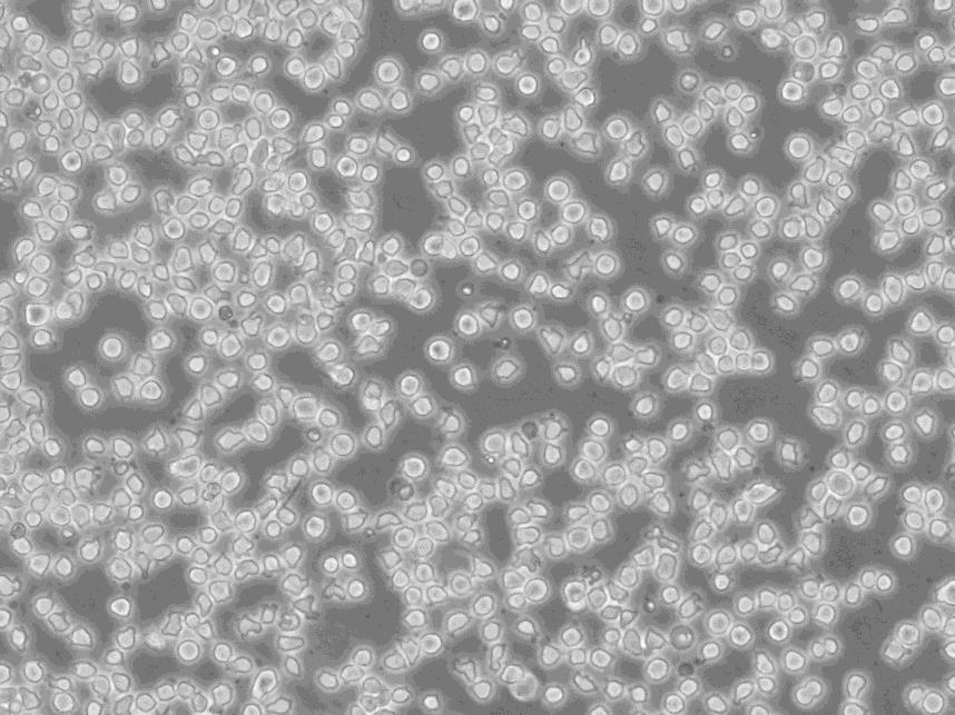 P3 NS1 Ag4/1 Cells#小鼠骨髓瘤細(xì)胞系保種中心(通過(guò)STR鑒定),P3 NS1 Ag4/1 Cells#