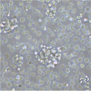 REC-1 Cells#人非霍奇金淋巴瘤细胞系种子库|STR图谱