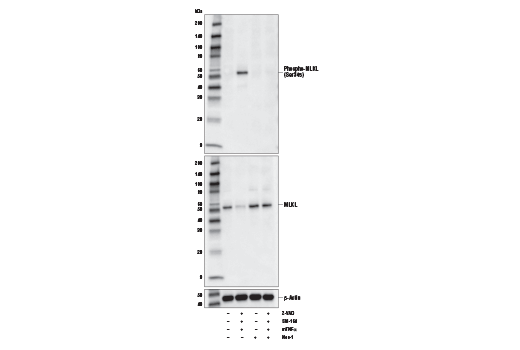 Phospho-MLKL (Ser345) (D6E3G) 兔單克隆抗體,Phospho-MLKL (Ser345) (D6E3G) Rabbit mAb