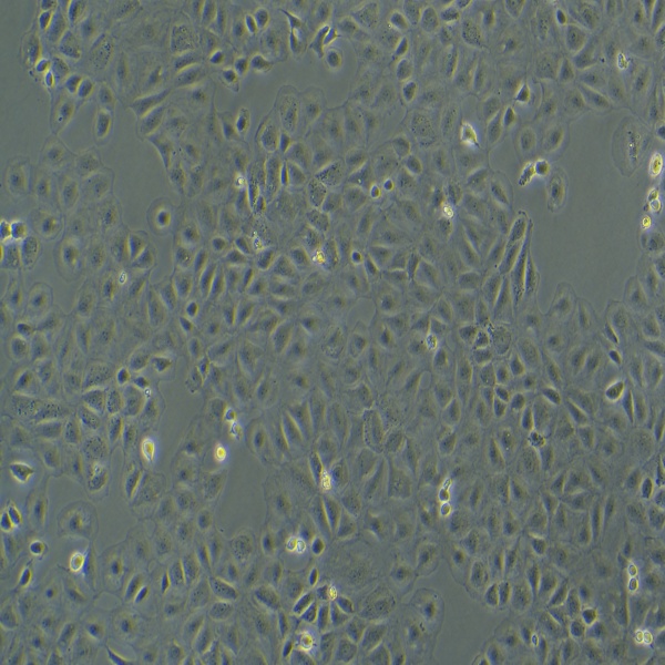 mda-mb2-31/luc细胞,mda-mb2-31/luc