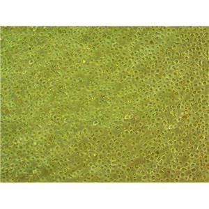 NK62a Cells#人Burkitt＇s淋巴瘤细胞系活性强|培养基|送STR图谱