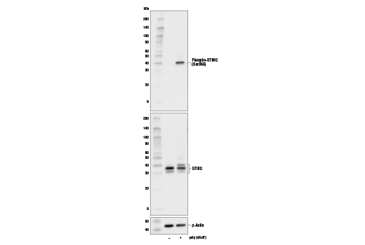 磷酸化STING (Ser366) (D7C3S) 兔單克隆抗體,Phospho-STING (Ser366) (D7C3S) Rabbit mAb