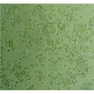 OE33 Cells#人食管腺癌细胞系源头种子库|培养基|STR图谱