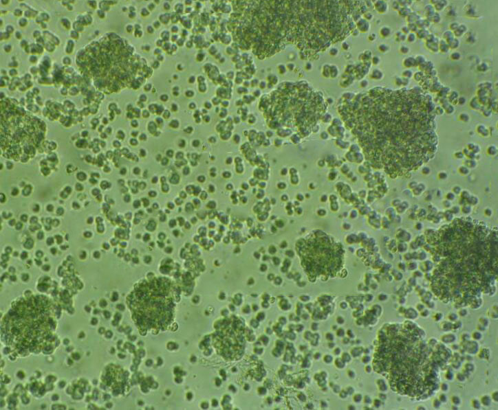 MOLP-8 cells人多發(fā)性骨髓瘤細胞系,MOLP-8 cells