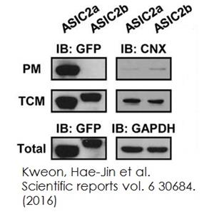 Plasma膜蛋白Extraction試劑盒(ab65400)(Abcam ab65400)