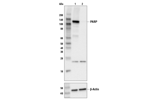 多聚（ADP-核糖）聚合酶 (46D11) 兔單克隆抗體,PARP (46D11) Rabbit mAb