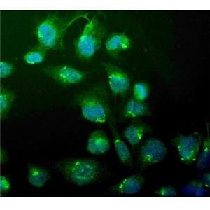 WEE1 Polyclonal Antibody(Thermo Fisher PA5-95636)