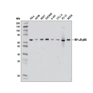 NF-kB p65 (D14E12) XP Rabbit mAb #8242(CST 8242T )