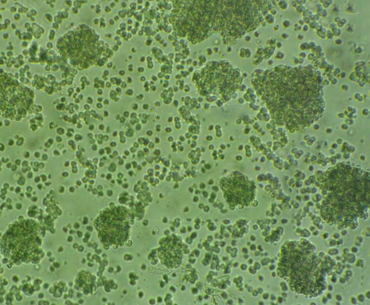 39AS8 cells人胃癌細(xì)胞系,39AS8 cells