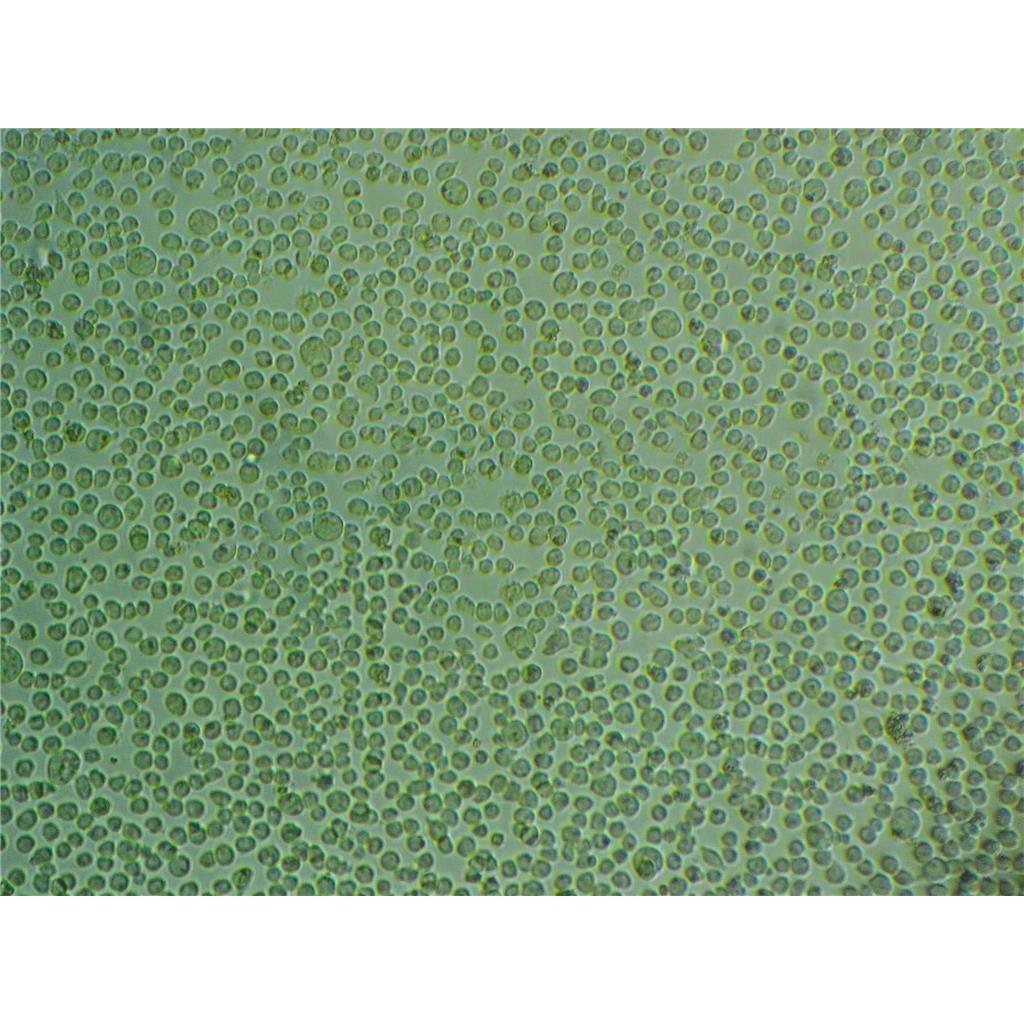 SK-GT-4 Cells#人食道癌腫瘤細(xì)胞系復(fù)蘇中心|完全培養(yǎng)基|STR圖譜,SK-GT-4 Cells#