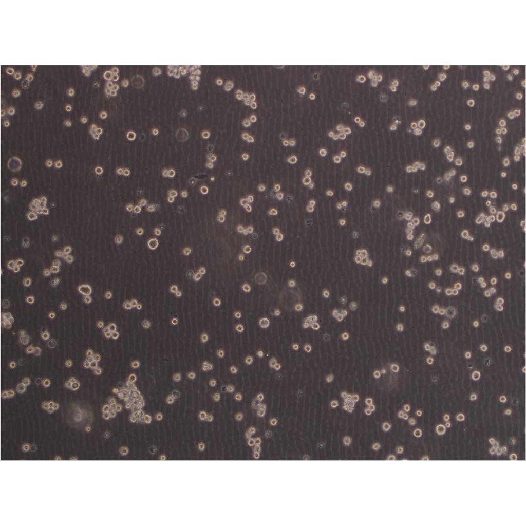 NCI-H1944 Cells#人肺癌細(xì)胞系復(fù)蘇中心|完全培養(yǎng)基|STR圖譜,NCI-H1944 Cells#