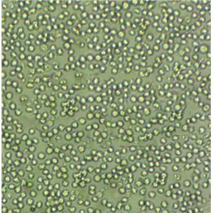 293T/17 Cells#人胚腎細(xì)胞系復(fù)蘇中心|完全培養(yǎng)基|STR圖譜