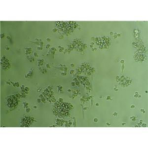 SF126 Cells#人腦瘤細(xì)胞系復(fù)蘇中心|完全培養(yǎng)基|STR圖譜