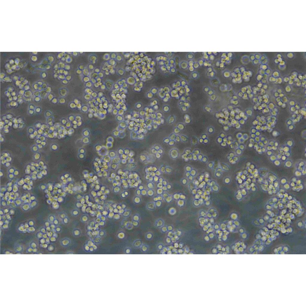 TR-LNN-1 Cells人喉癌淋巴結(jié)轉(zhuǎn)移細(xì)胞|帶STR證書,TR-LNN-1 Cells