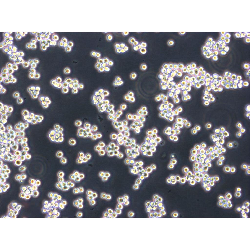 TE-1 Cells#人食管癌細(xì)胞系種子庫(kù)|完全培養(yǎng)基|STR圖譜,TE-1 Cells#