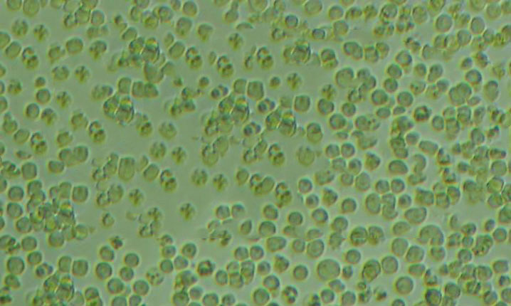 Capan-2 Cells#人胰腺癌細(xì)胞系實(shí)驗(yàn)室|完全培養(yǎng)基|鑒定圖譜,Capan-2 Cells#