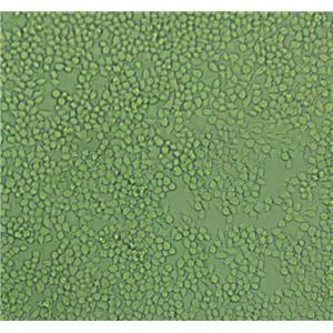 GBC-SD Cells#人胆囊癌细胞系实验室|完全培养基|鉴定图谱