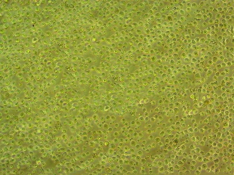 NCI-H727 Cells人肺癌細胞長期復(fù)蘇|帶STR圖譜,NCI-H727 Cells