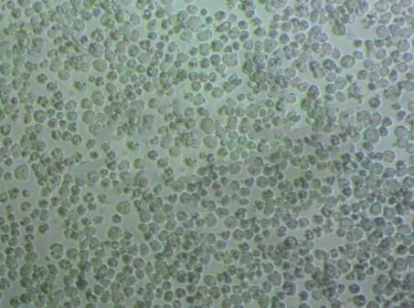 TMD8 Cells人彌漫性大B淋巴瘤細胞長期復(fù)蘇|帶STR圖譜,TMD8 Cells
