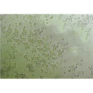 HBL-1 [Human diffuse large B-cell lymphoma] Cells人弥漫大B淋巴瘤细胞长期复苏|带STR图谱,HBL-1 [Human diffuse large B-cell lymphoma] Cells