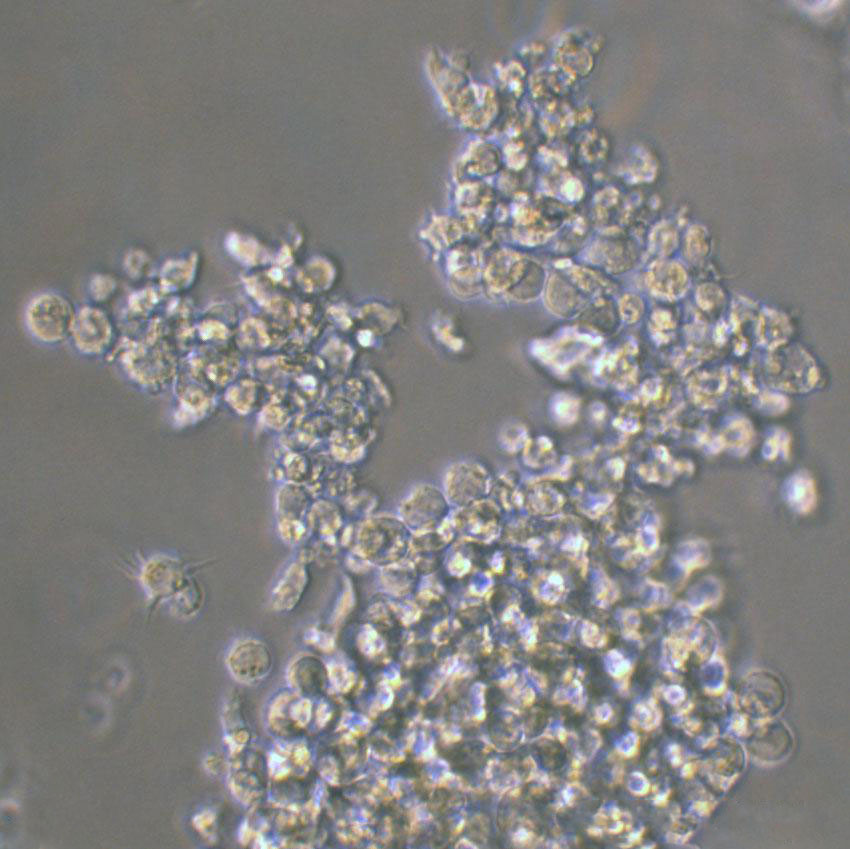 OVCAR-5人轉(zhuǎn)移性胃腸癌復(fù)蘇細(xì)胞|送STR報(bào)告,OVCAR-5
