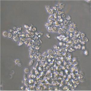 OVCAR-5人轉(zhuǎn)移性胃腸癌復(fù)蘇細(xì)胞|送STR報(bào)告,OVCAR-5