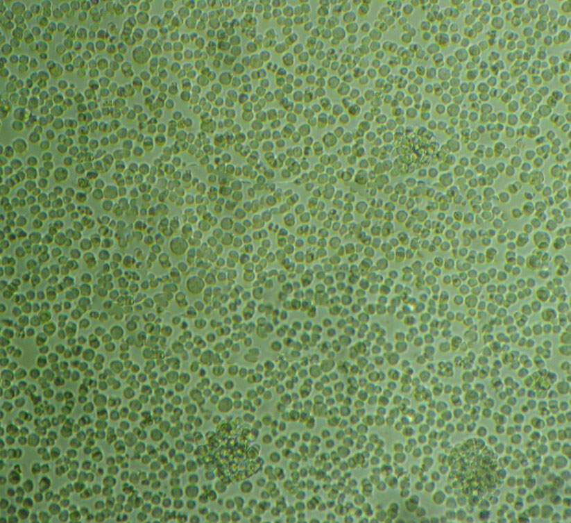 NP69SV40T Cells人鼻咽上皮細胞長期復蘇|帶STR圖譜,NP69SV40T Cells